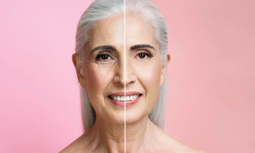 vita clinic - Anti-idade​