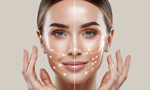 vita clinic - harmonização facial